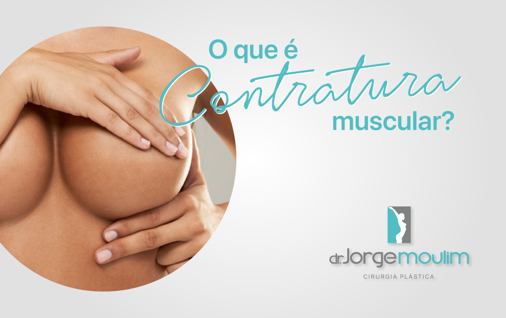 Dr Jorge Moulim - Cirurgia de Mama - Cirurgia Plástica - O que é Contratura Muscular?