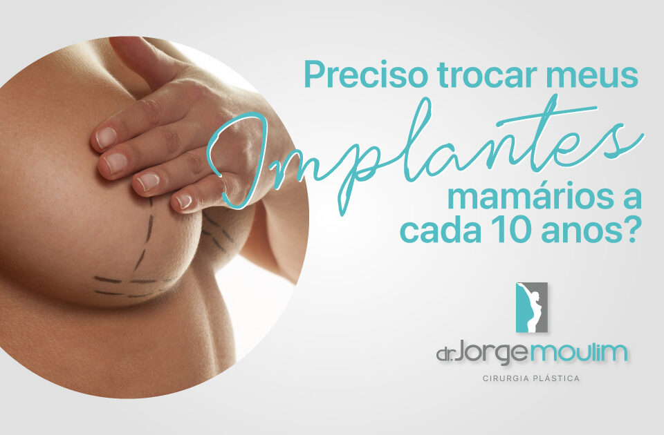 Dr Jorge Moulim - Cirurgia de Mama - Cirurgia Plástica - Preciso trocar meus implantes mamários a cada 10 anos?