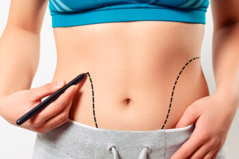 Fibrose após lipoaspiração: como identificar e o que fazer?