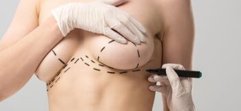 Laser na Cicatriz de Mamoplastia: A Revolução na Cicatrização Pós-Operatória