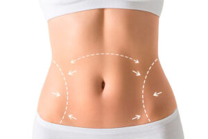 cirurgia-plastica-abdominoplastia