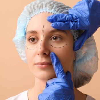 Blefaroplastia Superior e Inferior – Entenda as Diferenças