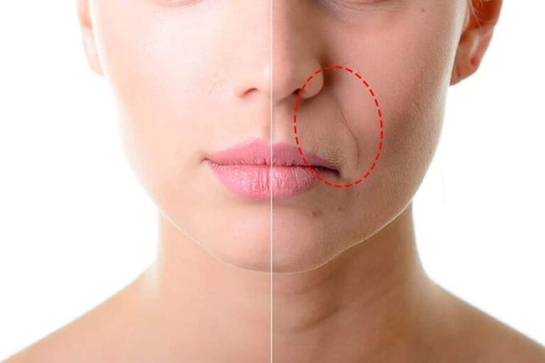 bigode chines antes e depois