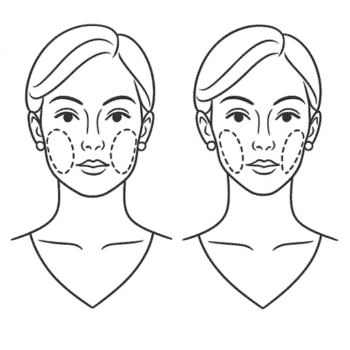 Bichectomia: Guia simples e completo