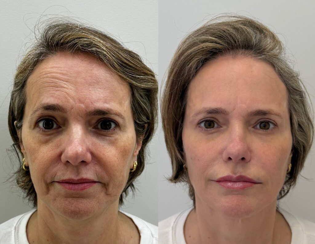 procedimento facial - cirurgiao plastico