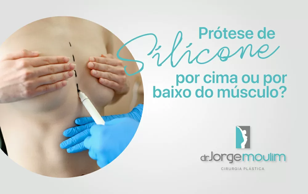 Prótese de Silicone: por cima ou por baixo do músculo?