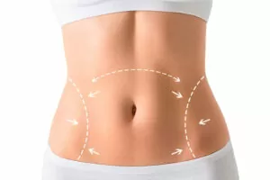 cirurgia-plastica-abdominoplastia