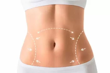 Lipo ou abdominoplastia: o que resolve a barriga flácida?