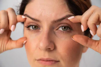 Blefaroplastia Inferior ou Preenchimento: Qual a Melhor Opção para Olheiras Profundas?